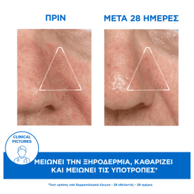 Uriage D.S. Emulsion Σμηγματορυθμιστική Κρέμα 40ml – φωτογραφία 2